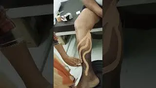 #kinesiotape for lower limb #lymphedema #swellingrelief #physiotherapy #viralshorts