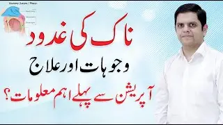 How to treat Nasal Polyps in Urdu/Hindi | ناک کی غدود | Dr. Muhammad Awais Sami QAS Health