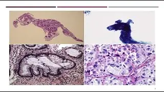Webinar:  Issues with Color in Histology in Medicine