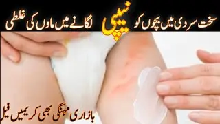 Baby Neppy Rashes ka Asaan Ilaj | Diaper nappy Rash||Home Remedy
