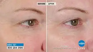 NassifMD Peri Orbital Eye Complex Duo