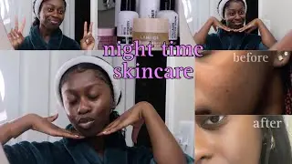 NightTime Skin Care Routine! | How I Faded Darkspots & Hyperpigmentation on Combination Dark Skin!