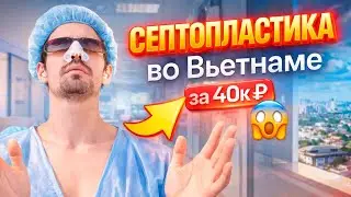 Септопластика во Вьетнаме за копейки. МОЙ НОС ЗАДЫШАЛ! Шок от больницы и восторг от результата.