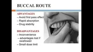 Is Buccal Route of drug administration Enteral or Parenteral type