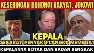 KESERINGAN BOHONGI RAKYAT JOKOWI SEKARAT PENYAKIT LANGKA MEMBUAT KEPALANYA BOTAK DAN BADAN BENGKAK