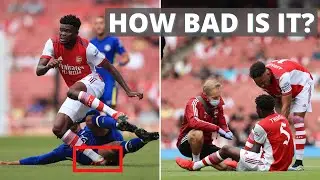 Expert explains Thomas Partey Ankle Injury | Possibilities & Timelines
