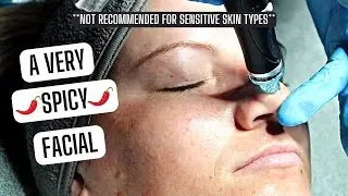 DERMAPLANING + HYDRAFACIAL | EXFOLIATING FACIALS | SKIN REJUVENTION FACIALS