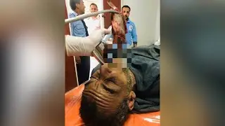 تفاصيل ابتلاع صياد بني سويف سمكة حية