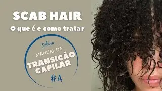 TRANSI&Ccedil;&Atilde;O CAPILAR/ SCAB HAIR/ COMO TRATAR? EP3