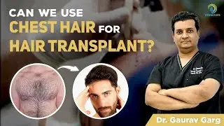 Can we use Chest Hair for Hair Transplant? | India&rsquo;s Top Celebrity Hair Transplant Surgeons