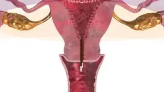 How Dilapan-S  Cervical Dilator Work