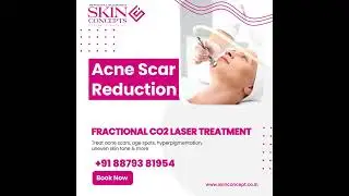 Acne Scar Reduction