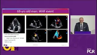 Refractory heart failure: combining oral therapy and device is key
