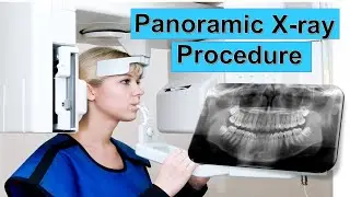 Panoramic Dental X-Ray Procedure EXPLAINED | PANORAMIC XRAY | Panoramic radiography (OPG)