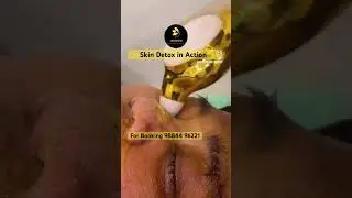 Skin Detox Facial Cupping ✨ Instant Glow Therapy | No Needles | No Downtime