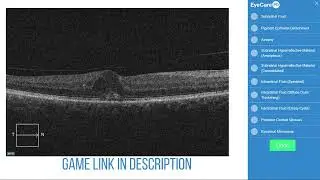 What do you see? Try OCT Challenge 14!