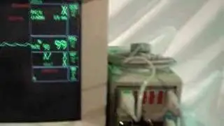 GE Marquette Solar 8000 Patient Monitor