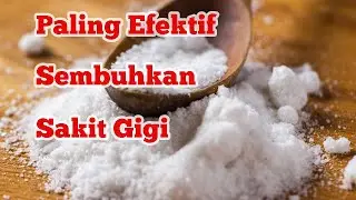 4 Obat Herbal Alami Untuk Sakit Gigi #obatherbalsakitgigi