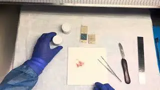 Bone Marrow Clot and Core Prosection