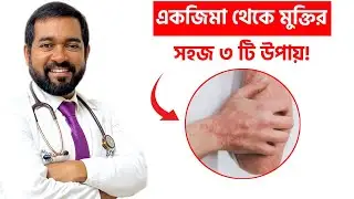 জেনে নিন একজিমা থেকে মুক্তির সহজ ৩ টি পদ্ধতি! Dr Mojibul Haque