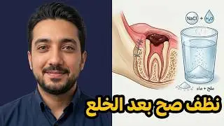 How to Clean Your Teeth After Wisdom Tooth Extraction