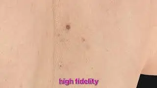How often should I get a skin screening