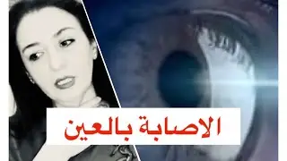الإصابة بالعين