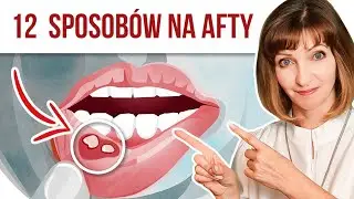 🍀 12 naturalnych sposob&oacute;w na AFTY 🍀 Czym płukać usta? cz.2