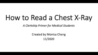 How to Read a Chest X-Ray