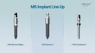 D&eacute;couvrez l'Implant MS d'Osstem &ndash; Performance et Fiabilit&eacute; en 40s !