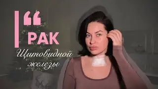 Как я узнала о диагнозе, рак щитовидной железы ?!😮‍💨