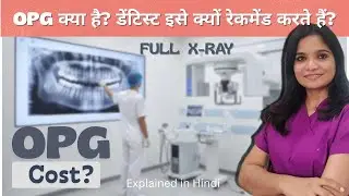 OPG | मुँह का बड़ा X-ray क्या होता है? कीमत कितनी? पूरी जानकारी  | Dental X-ray 🩻