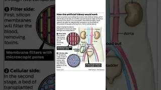 If your kidneys are in danger? How the artificial kidney would work #artificialkidney