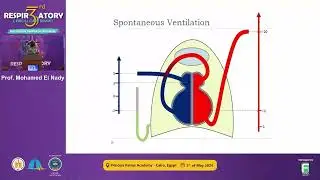Heart-Lung Interactions During Mechanical Ventilation