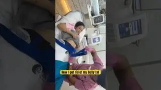 Эта процедура заставила мой жир на животе исчезнуть 😳 #шорты