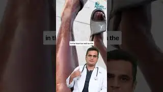 Doctor Reacts: Shiny Legs, a Clinical Look at the Underlying Cause