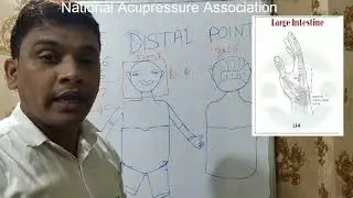 TCM Acupuncture ,Distal points