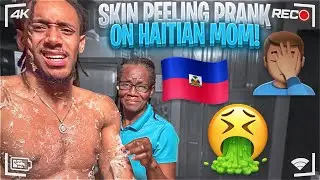 Skin Peeling Prank on Haitian Mom! *GONE WRONG SHE SPAZZED*