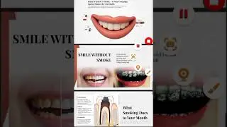 NDPC UG 059 | Areesha Khan | Watim Dental College | | LCMD x Bosch