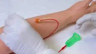 Surshield Winged Infusion Blood Collection Sets IFU Video