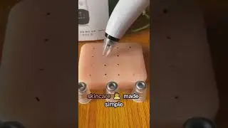 Product Link in the Comments! Pure Skin Rechargeable Blackhead Remover Machine⁠