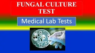 FUNGAL CULTURE TEST - Medical  Lab Tests -  What is ? , Uses , Need , Preparation , Results