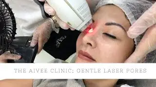GENTLE LASER PORES AT THE AIVEE CLINIC | Cat Arambulo-Antonio