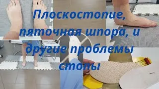 Foot problems and treatment