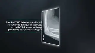 Definium&trade; 656 HD Product Video