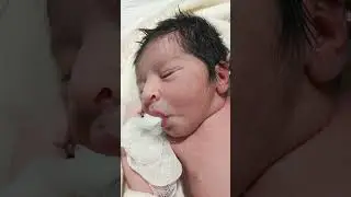 good suck reflex of baby | NICU care | Baby #newborncare #baby