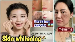 The Screat to healthy and younger looking skin boost collagen OMI WHITE CREAM |Advanced Whitening |