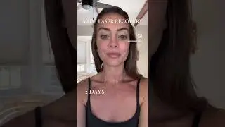 MOXI LASER RECOVERY PROCESS- skin care treatment, skin rejuvenation, facial laser
