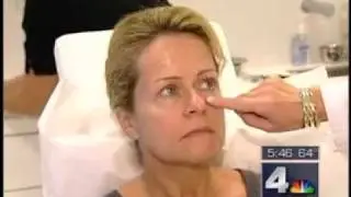 Dr. Tina Alster on Nonsurgical Eye Lift with Thermage, Botox and Dermal Filler
