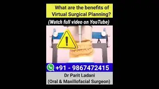 Benefits of Virtual Surgical planning in Corrective Jaw Surgery | Dr Parit Ladani